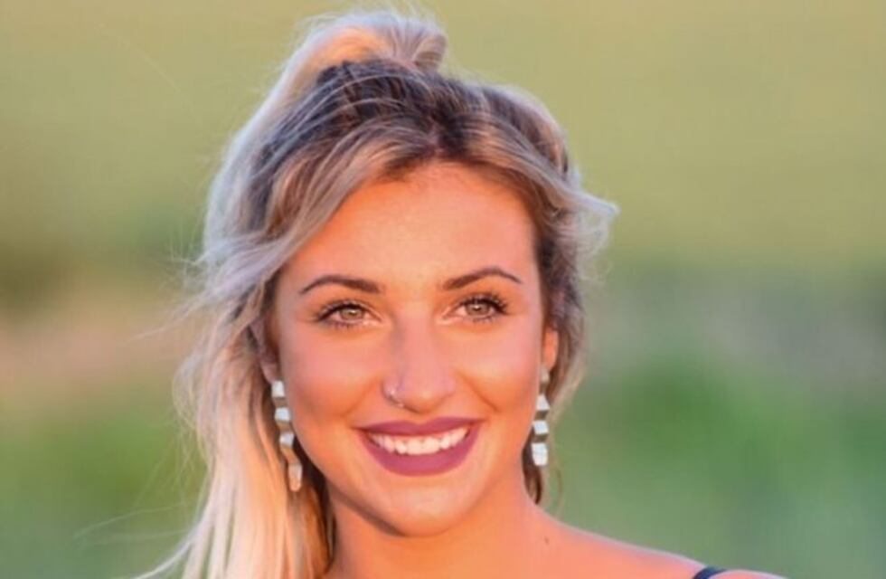 El radical cambio de Bianca Iovenitti, la exnovia de Fede Bal, tras su paso por el quirófano