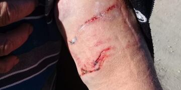 Foto: gentileza diario Río Negro\u002E