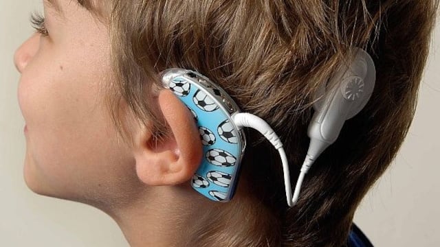 Implante coclear que posee el pequeño mendocino.