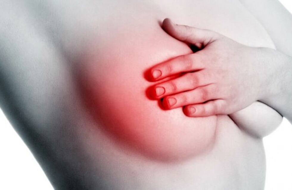 Disertación: "Tratamiento actual de Cáncer de mama y perspectivas futuras"