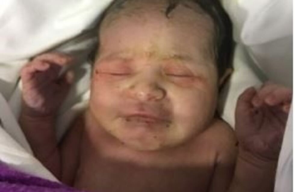 Encontraron a una beba abandonada con el cordón umbilical y le pusieron Milagros