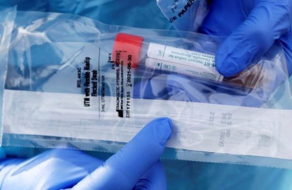 Coronavirus: China entregó a la Argentina 1500 kits de reactivos rápidos