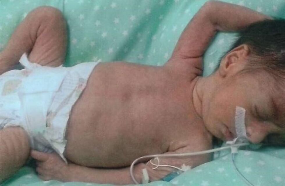 Córdoba: dan de alta a trillizas naturales que nacieron prematuras