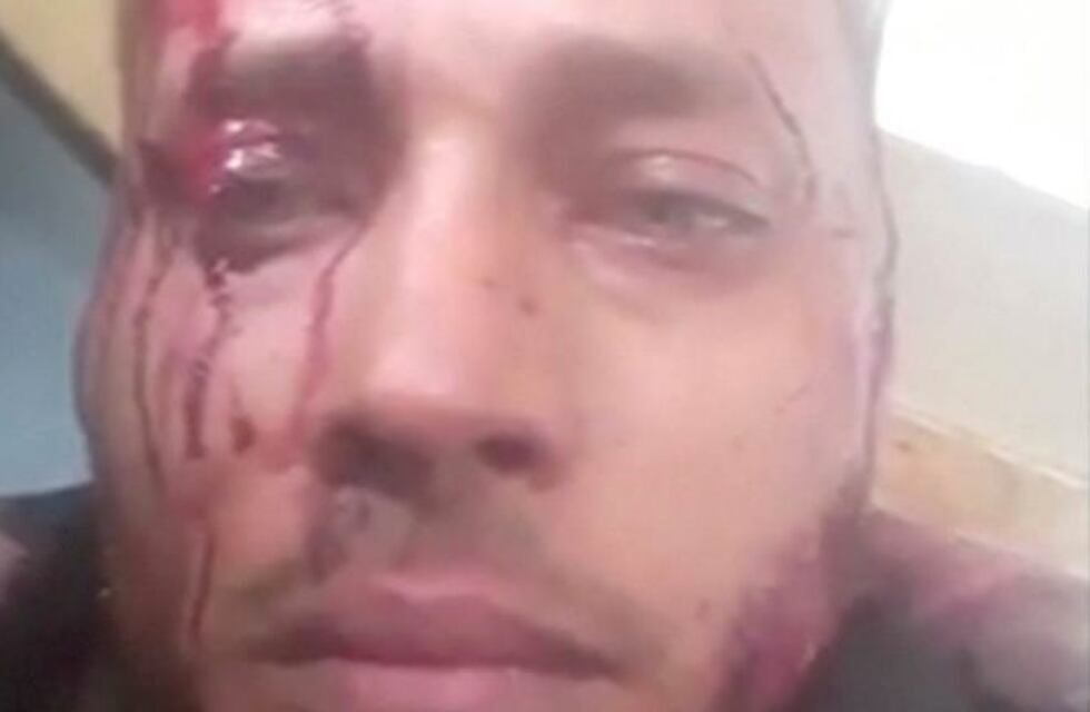 Crece la incertidumbre en Venezuela sobre la muerte de Oscar Pérez