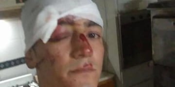 Robaron y tiraron de un tren a otro joven en Don Torcuato