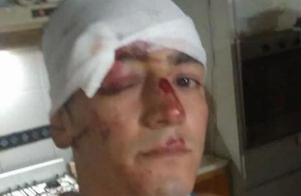 Robaron y tiraron de un tren a otro joven en Don Torcuato