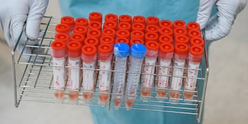 A medical worker handles vials containing swab samples to be tested for Covid-19 at a polymerase chain reaction (PCR) testing site inside Narita Airport in Narita, Chiba Prefecture, Japan, on Sunday, July 19, 2020\u002E More Japanese people are discontent with the governme casos del dia bloomberg