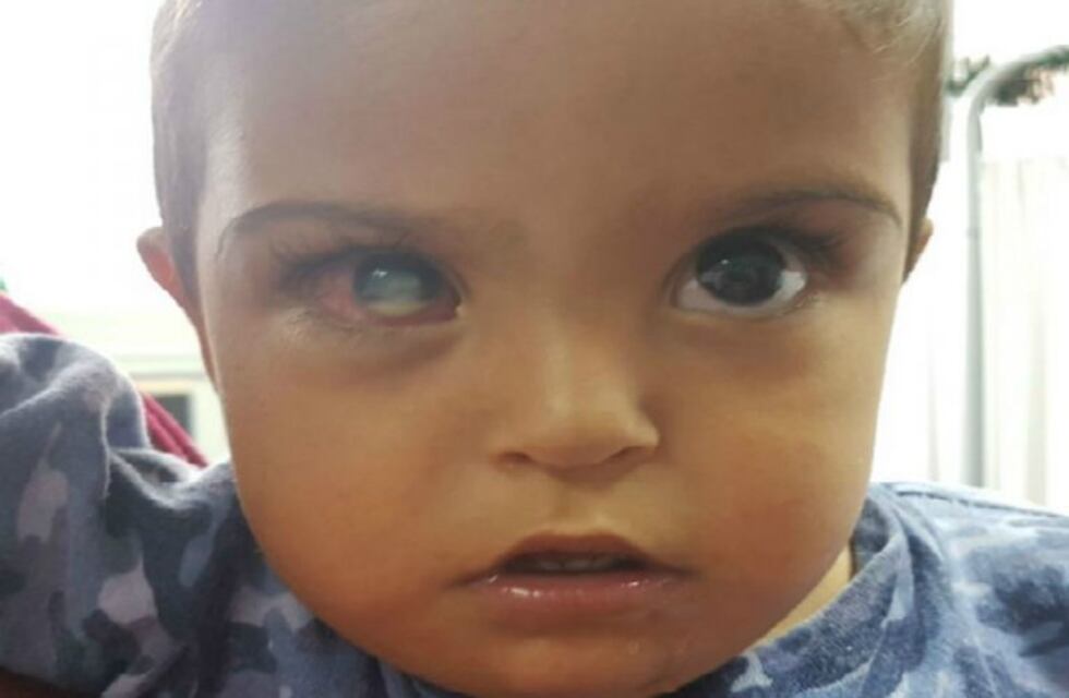 El menor que padecía una afección en el ojo apareció junto a su madre en Rosario