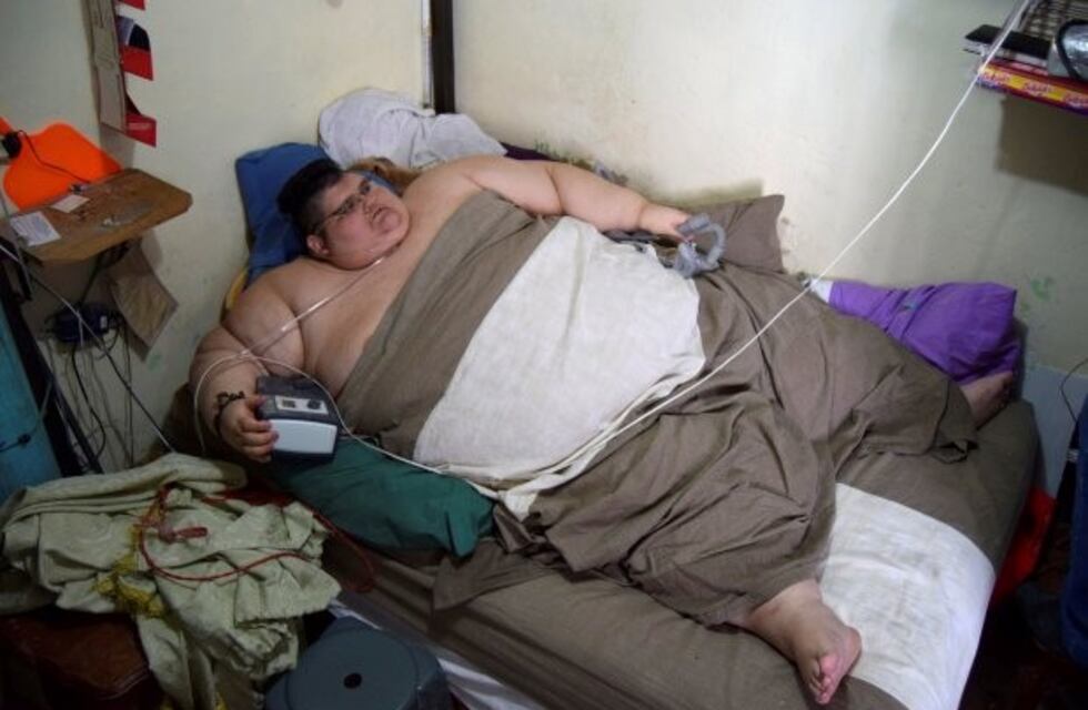 El hombre más obeso del mundo ya bajó 218 kilos y espera pesar 90 en un año y medio