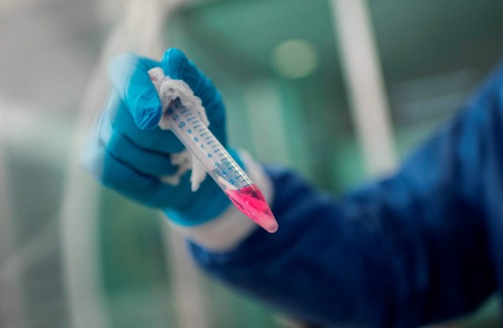 Coronavirus en San Francisco: 65 nuevos casos
