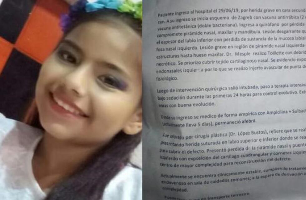 Una niña debe realizarse cirugías reconstructivas por las mordeduras de un perro y necesita ayuda