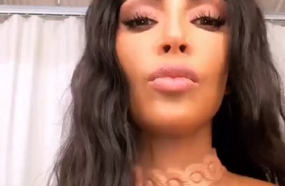 Kim Kardashian se implantó un collar bajo la piel