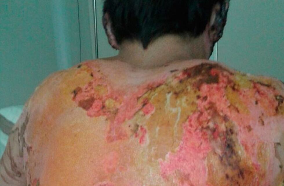 El estremecedor relato de uno de los sobrevivientes de la explosión de Cofco