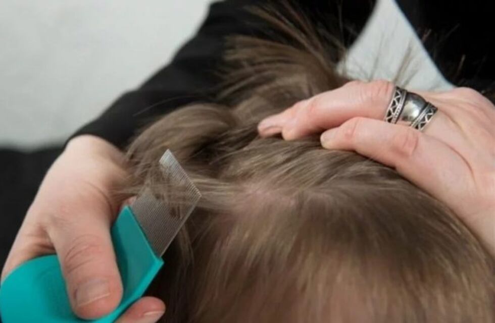 Grabó la cabellera llena de piojos de una chica en el colectivo y el video se volvió viral