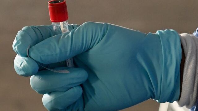 NORTH LAS VEGAS, NEVADA - NOVEMBER 12: Spc\u002E Demetrie Barnett of the Nevada National Guard gets a coronavirus (COVID-19) specimen sampling tube ready as he administers tests during a preview of a free drive-thru COVID-19 testing site in the parking garage of the Texas Station Gambling Hall & Hotel on November 12, 2020 in North Las Vegas, Nevada\u002E The site will open on November 13 amid increased demand for testing due to a surge in coronavirus cases in the state\u002E Over the past two weeks, Nevada has averaged close to 1,000 new coronavirus cases per day, with a 13\u002E7 percent test positivity rate\u002E Clark County is partnering with the Southern Nevada Health District, Nevada National Guard, University Medical Center of Southern Nevada, city of North Las Vegas and Station Casinos, which owns the property, to open the site\u002E Texas Station has been closed since mid-March because of the pandemic\u002E   Ethan Miller/Getty Images/AFP\n== FOR NEWSPAPERS, INTERNET, TELCOS & TELEVISION USE ONLY ==