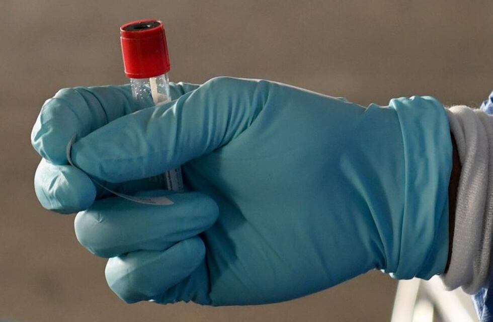 Coronavirus: 1.309 casos en Santa Fe, 377 en Rosario y 12 fallecidos