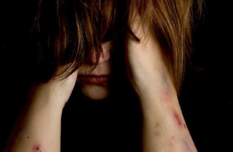 Tres alumnas se autoflagelaron en San Rafael