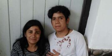 Desconsuelo, miedo, es lo que reflejan los rostros de Jason Contreras y su madre\u002E