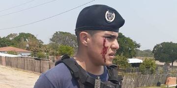 Los enfrentamientos fueron violentos y hubo heridos de ambos bandos