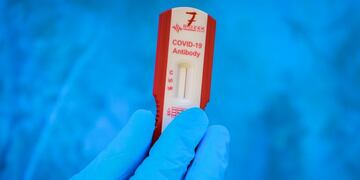 Coronavirus test\u002E