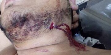 El joven fue abordado por dos delincuentes, quienes lo apuñalaron pese a robarle\u002E (Flash 24)