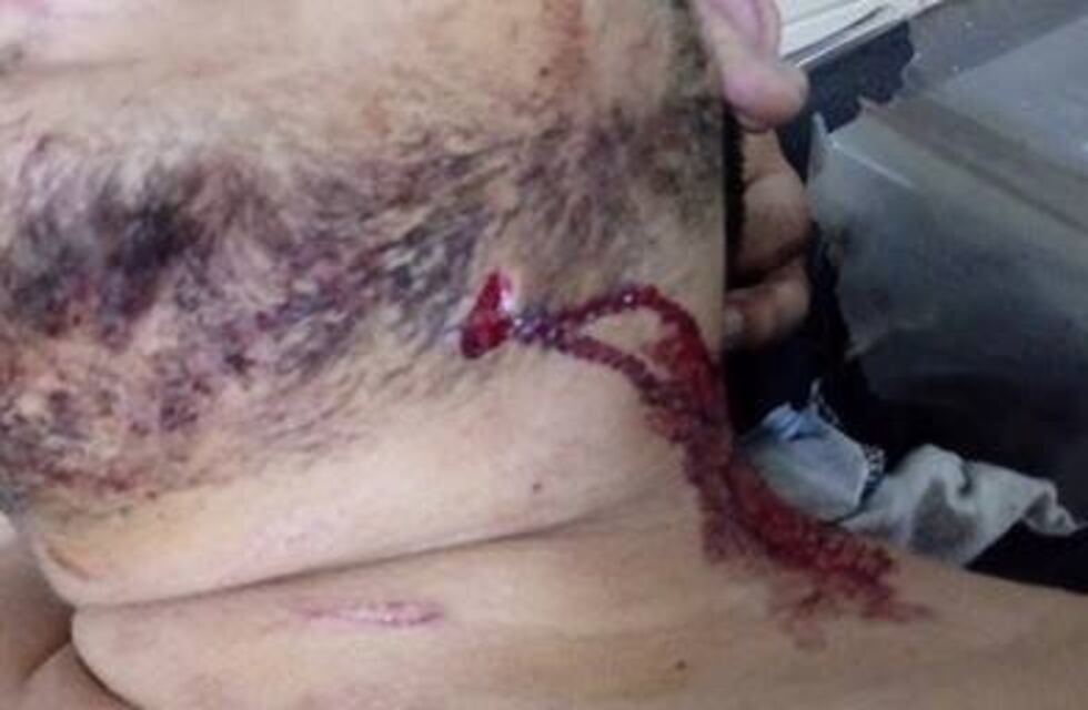 Feroz ataque a un joven para robarle la mochila: fue apuñalado pese a no resistirse