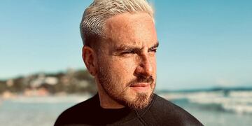 Fede Bal relató cómo fue su accidente en Brasil