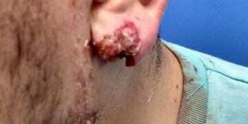 Emmanuel Rico afirmó que lo golpearon y aportó fotos y video\u002E La Inspección General de Seguridad analiza el caso\u002E