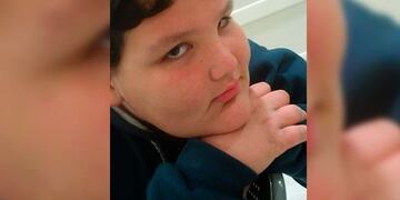 Una madre pide ayuda para cubrir el tratamiento que necesita su hijo con obesidad\u002E Fotos: El Once