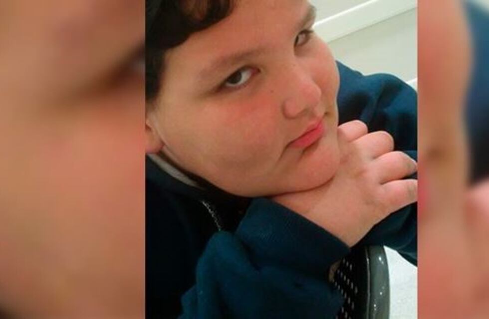 Una madre pide ayuda para cubrir el tratamiento que necesita su hijo con obesidad