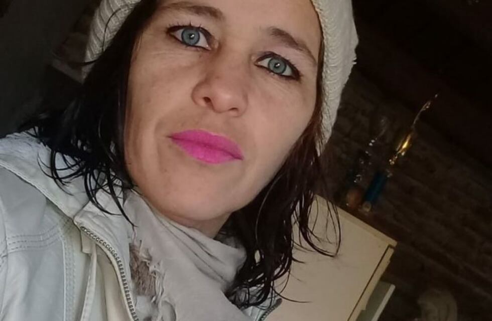 Murió la mujer que habría sido quemada por su pareja en Melchor Romero