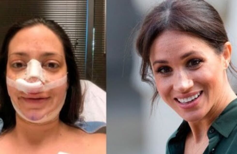 Pagó USD 22.500 en cirugías plásticas para parecerse a Meghan Markle