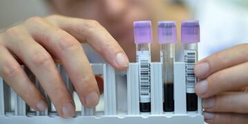 LAUSANA (SUIZA) 11/06/2014\u002E- Un técnico del Laboratorio Suizo para el Análisis de Dopaje enseña muestras de orina y sangre en el hospital universitario Vaudois (CHUV) en Lausana (Suiza) hoy, miércoles 11 de junio de 2014\u002E El jefe del Laboratorio Suizo para el Análisis de Dopaje, Martial Saugy, y su equipo serán los encargados de dirigir los análisis antidopaje para el Mundial de Brasil 2014\u002E EFE/Christian Brun lausana suiza  analisis de dopaje muestra de sangre futbol analisis antidopaje para el Mundial de Brasil 2014