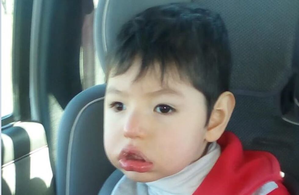 Futbolistas y artistas enrolados en ayudar a un niño chaqueño