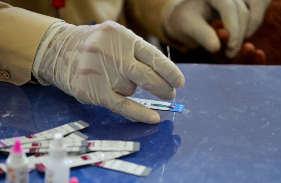 La Calera: Realizarán test de VIH con resultados en 10 minutos