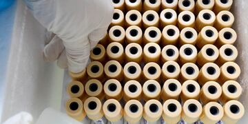 A medical specialist wearing a protective suit places testing samples of travellers who have returned from Da Nang, to a box at a rapid testing center for the coronavirus disease (COVID-19) in Hanoi, Vietnam August 10, 2020\u002E REUTERS/Kham