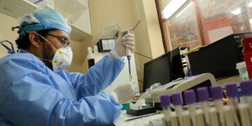 A lab technitian works on blood samples at the Cesar Garayar support hospital in the city of Iquitos, in the Amazon basin, on May 22, 2020, dedicated to endemic diseases like dengue, malaria, chikunguya and leptospirosis that still affect the population in addition to the arrival of the novel coronavirus that has claimed the lives of 14 doctors at this facility, not dedicated to harbor Covid19 cases\u002E - Focused attention on fighting the new coronavirus in Peru has detracted the ability to combat the dengue fever, an explosive situation in the Amazon region, where it is leaving a trail of disease and death in cities and remote indigenous villages\u002E (Photo by Cesar Von BANCELS / AFP)