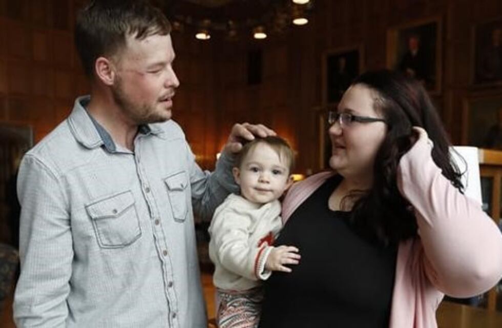 El emotivo encuentro entre la viuda de un donante de rostro y el paciente