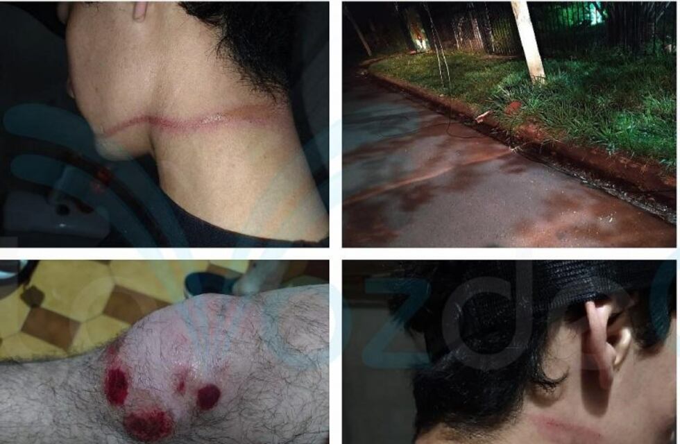 Motociclista denunció que casi fue decapitado por un cable suelto