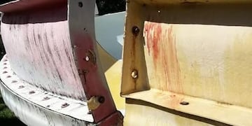 La peor diversión: una pareja se accidentó en un parque acuático de Mar del Plata (Foto: Facebook Noe Medina)