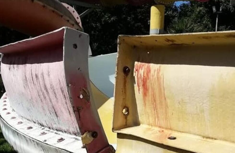 La peor diversión: una pareja se accidentó seriamente en un parque acuático de Mar del Plata