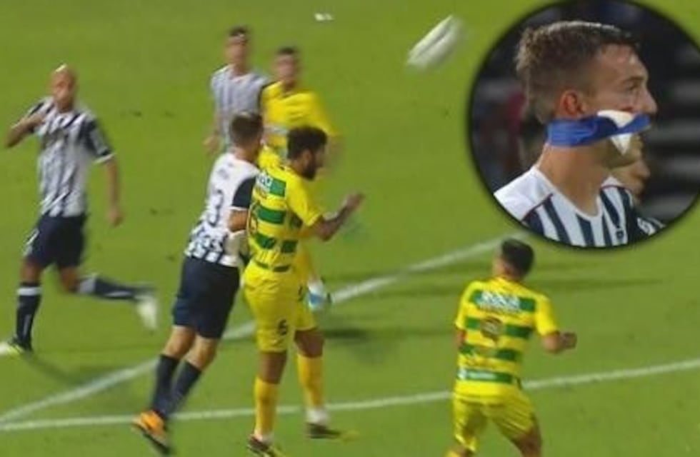 Traumatismo y cinco puntos de sutura para Komar por el codazo de Barboza