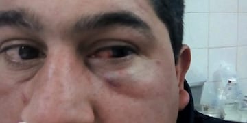 Villa Unión: detuvieron a los hijos de un Diputado tras agredir a policias en un boliche