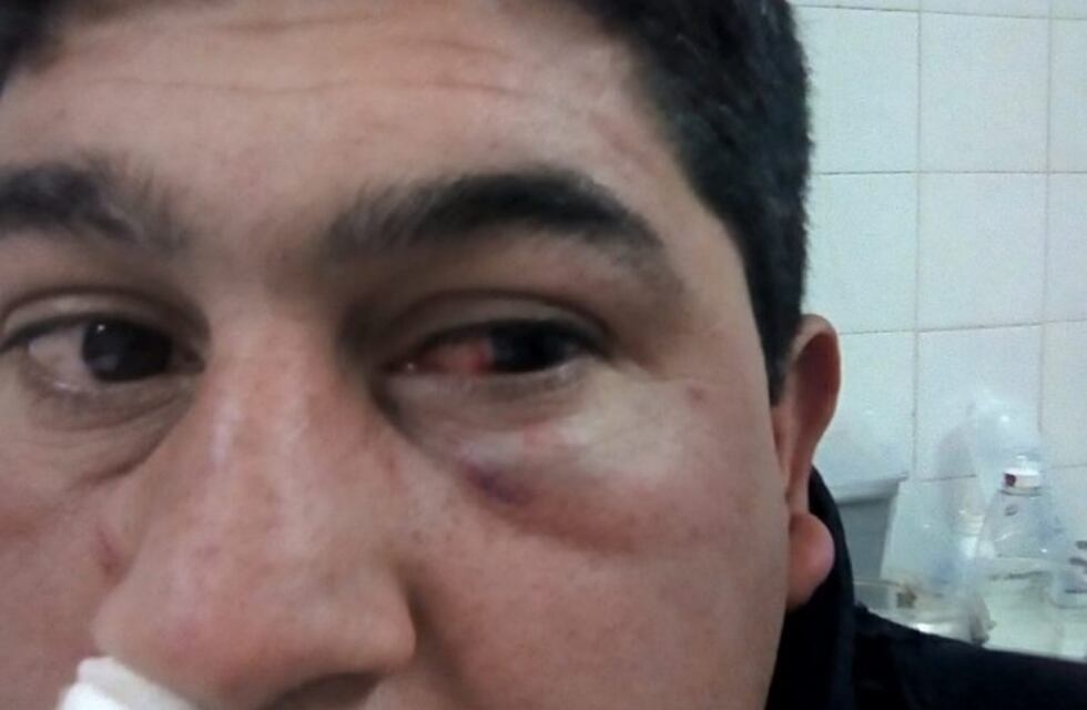 Villa Unión: detuvieron a los hijos de un Diputado tras agredir a policías en un boliche