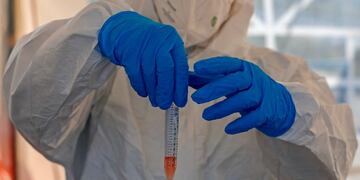 A paramedic with Israel's Magen David Adom (Red Shield of David) national emergency medical service, holds a swab tube at a drive-thru testing service for COVID-19 coronavirus in Jerusalem on August 27, 2020\u002E (Photo by AHMAD GHARABLI / AFP)
