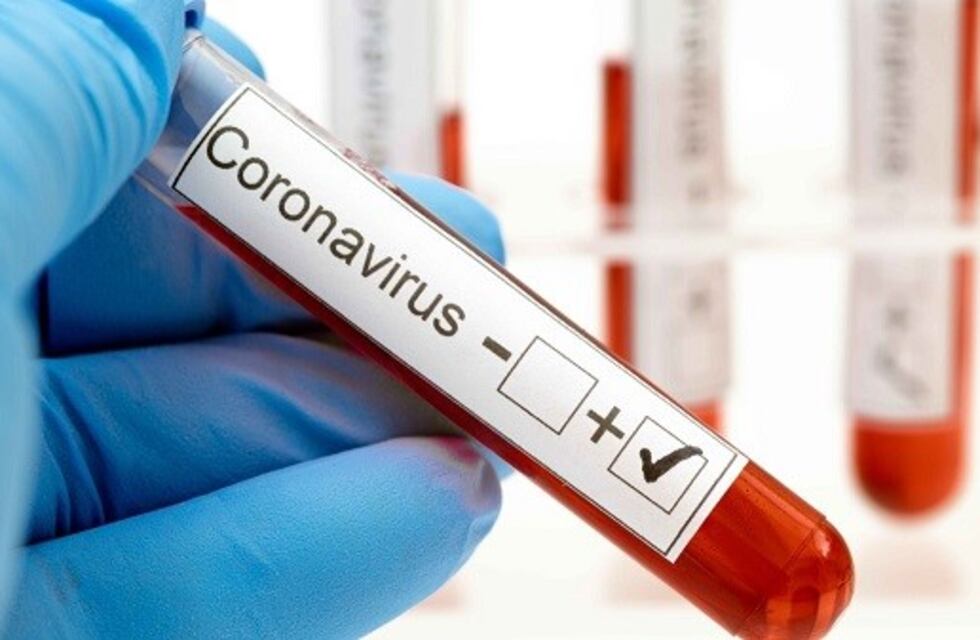 San Antonio registró su primer caso de Coronavirus