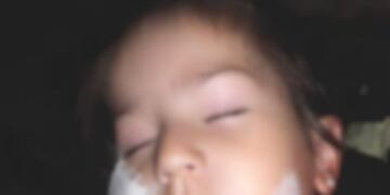 El ataque de un perro a una nena de dos años en Río Cuarto\u002E