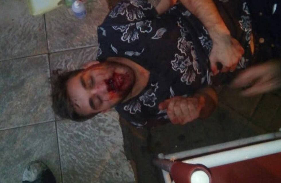 Trapito redujo a trompadas a un joven para robarle en Salta y Oroño