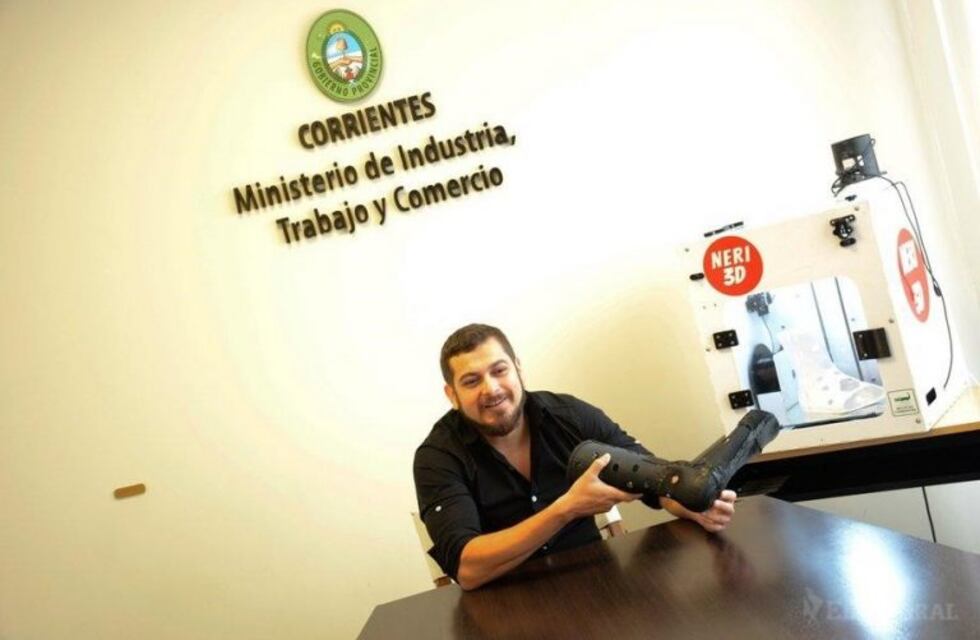 Emprendedor correntino fabricó una férula con una impresora 3D