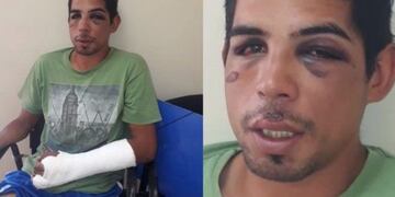 Recibió una paliza tras intentar robar una moto a un policía